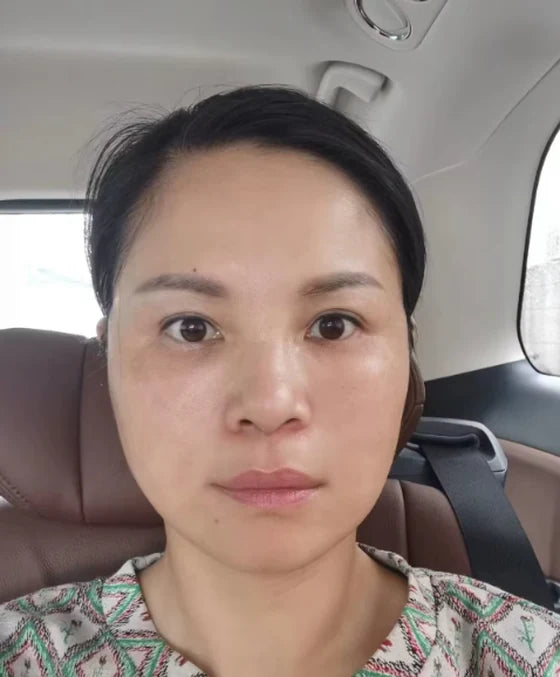 Rostro de una usuaria tras varias semanas de uso